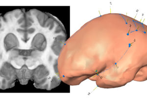 El CENIEH presenta un nuevo estudio de la forma cerebral en la evolución humana