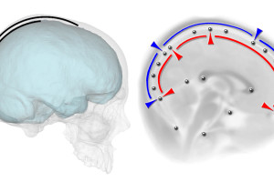 Nuevo estudio sobre las relaciones espaciales entre cerebro y cráneo en los humanos modernos