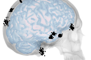 Se realiza un nuevo estudio sobre la integración entre cráneo y cerebro