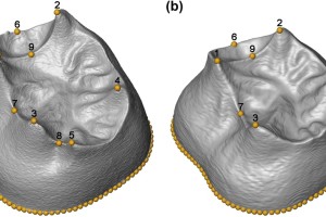 Primer estudio morfométrico en 3D de los molares de la Sima de los Huesos
