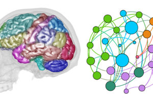 Se aplica el análisis de redes al estudio de la macroanatomía cerebral